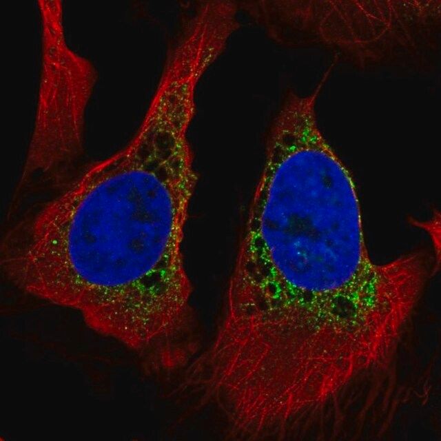 Anti-PMFBP1 antibody produced in rabbit