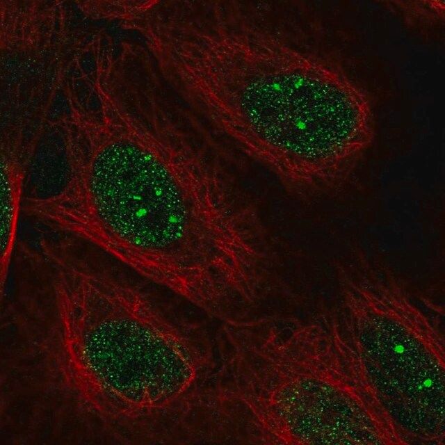 Anti-POLK antibody produced in rabbit