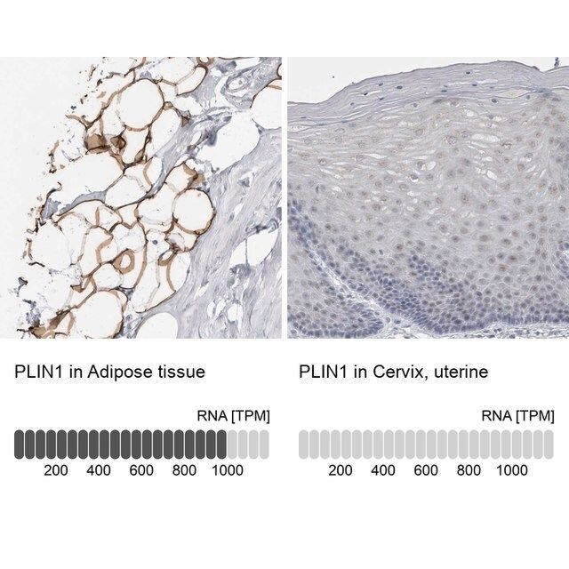 Anti-PLIN1 antibody produced in rabbit