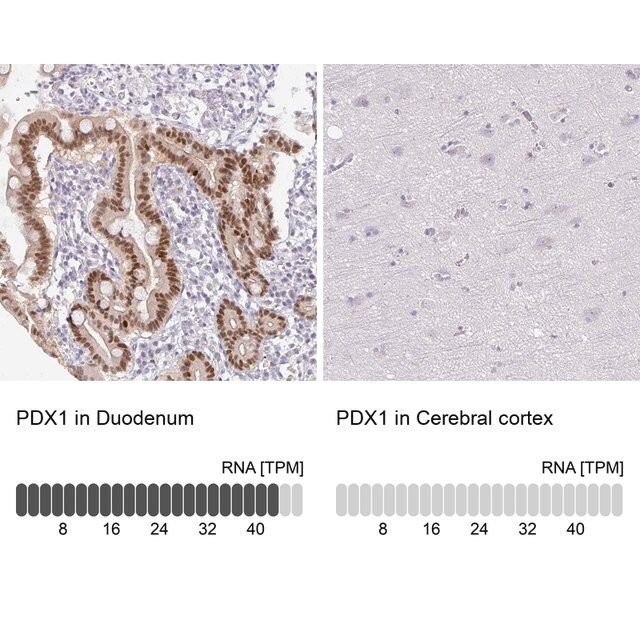 Anti-PDX1 antibody produced in rabbit