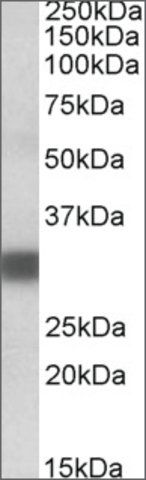 Anti-PDXP (C-terminal) antibody produced in goat