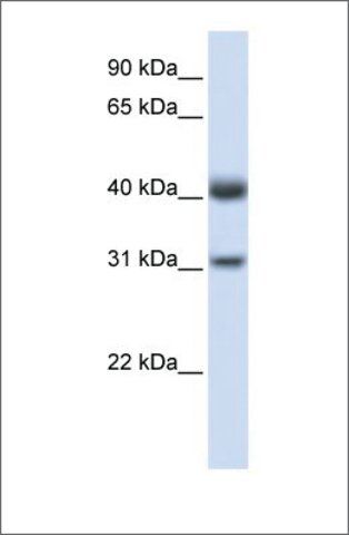 Anti-PDSS2 antibody produced in rabbit