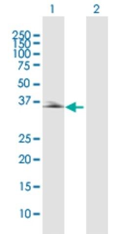 Anti-PDLIM2 antibody produced in rabbit