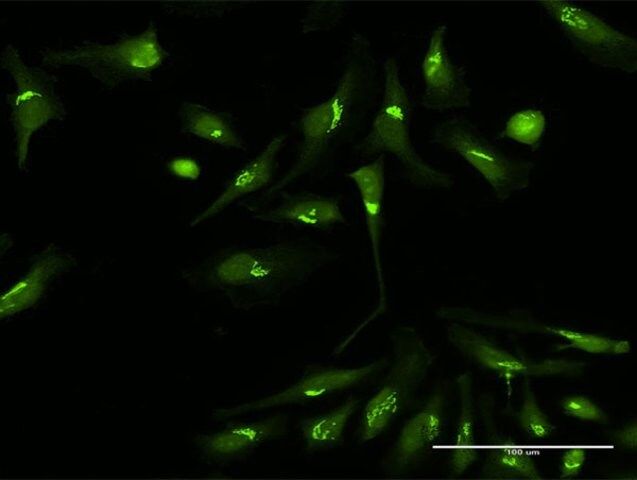 Anti-PDXDC1 antibody produced in rabbit