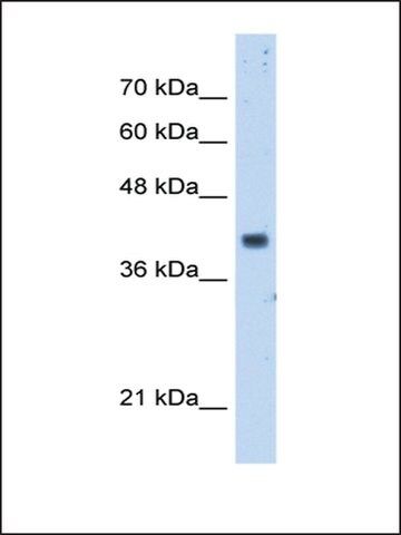 Anti-PDSS1 antibody produced in rabbit