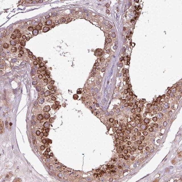 Anti-PDPR antibody produced in rabbit