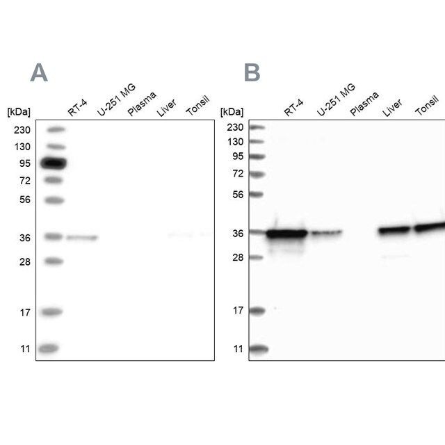 Anti-PDXK antibody produced in rabbit