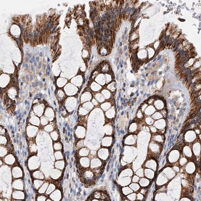 Anti-PDSS2 antibody produced in rabbit