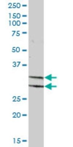 Anti-PDXK antibody produced in mouse