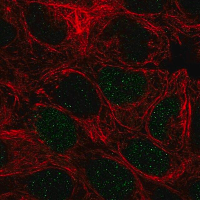 Anti-PEPD antibody produced in rabbit