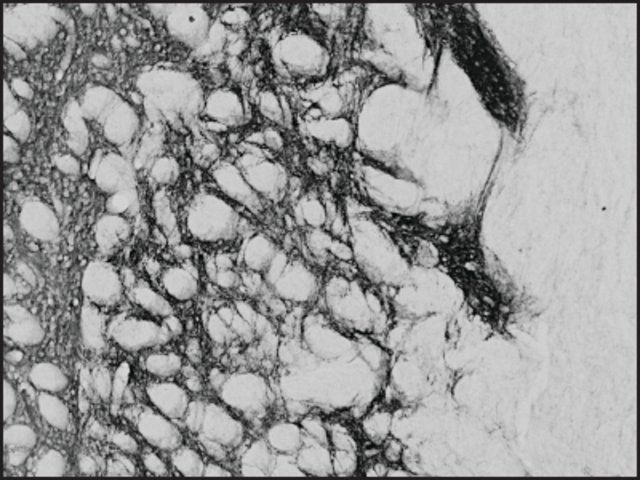 Anti-PENK antibody produced in goat