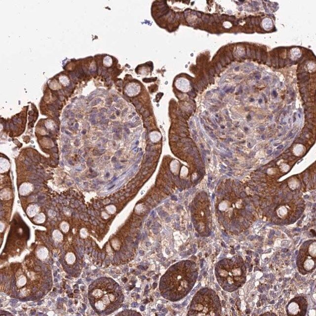 Anti-PEX19 antibody produced in rabbit