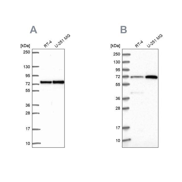 Anti-PES1 antibody produced in rabbit