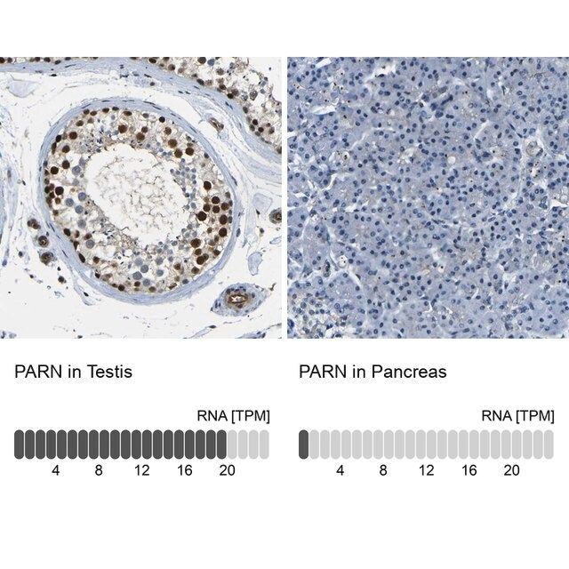 Anti-PARN antibody produced in rabbit