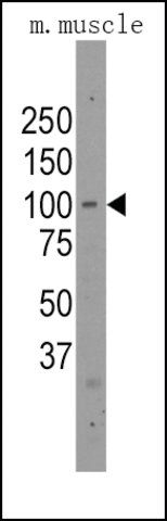 Anti-PARP12 (C-term) antibody produced in rabbit