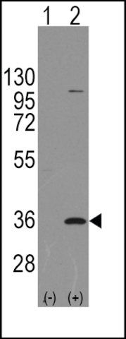 Anti-PARP16 (C-term) antibody produced in rabbit