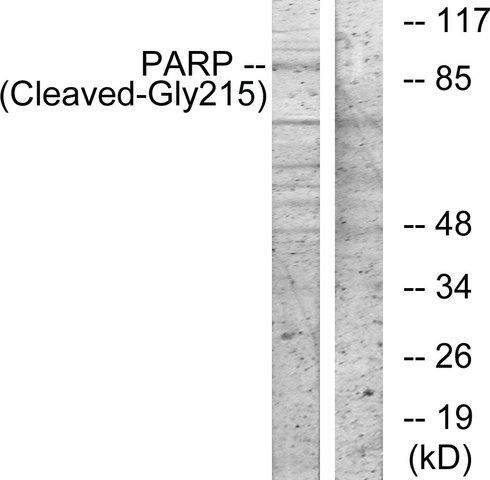 Anti-PARP (Cleaved-Gly<sup>215</sup>) antibody produced in rabbit