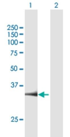 Anti-PARP16 antibody produced in mouse