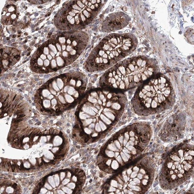 Anti-PARM1 antibody produced in rabbit