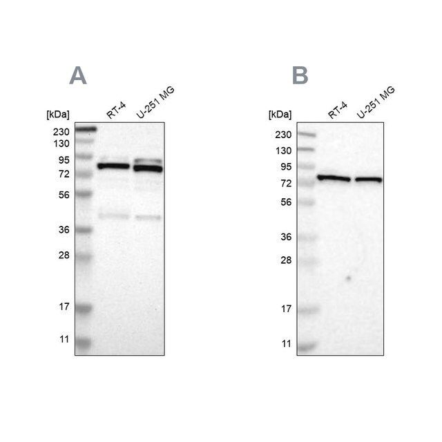 Anti-PARN antibody produced in rabbit