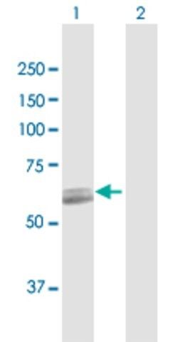 Anti-PCCB antibody produced in rabbit