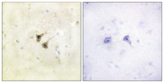 Anti-PBK antibody produced in rabbit