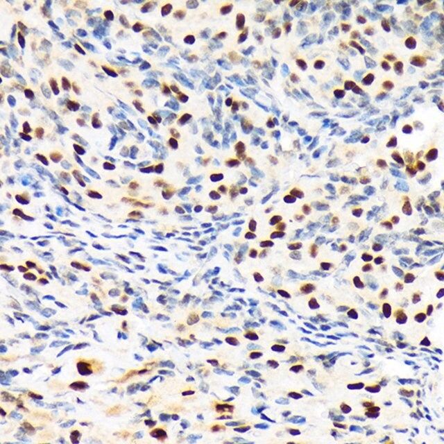 Anti-PBRM1 antibody produced in rabbit