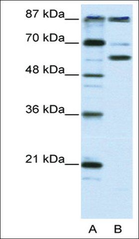 Anti-PCAF antibody produced in rabbit