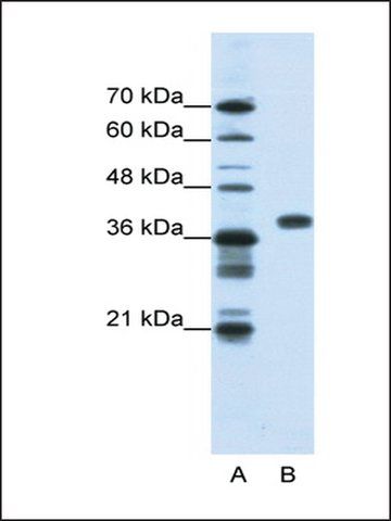 Anti-PCBP1 antibody produced in rabbit