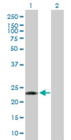 Anti-PCTP antibody produced in mouse