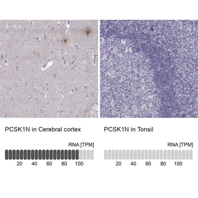 Anti-PCSK1N antibody produced in rabbit