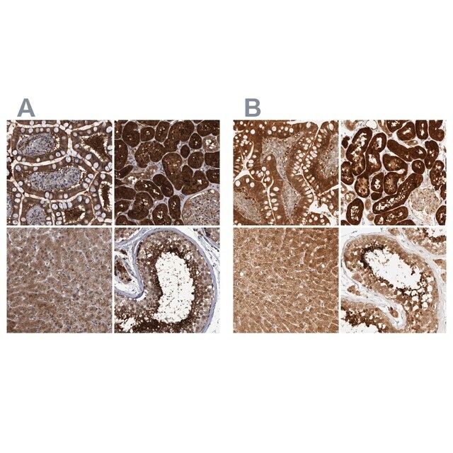 Anti-PCYT2 antibody produced in rabbit