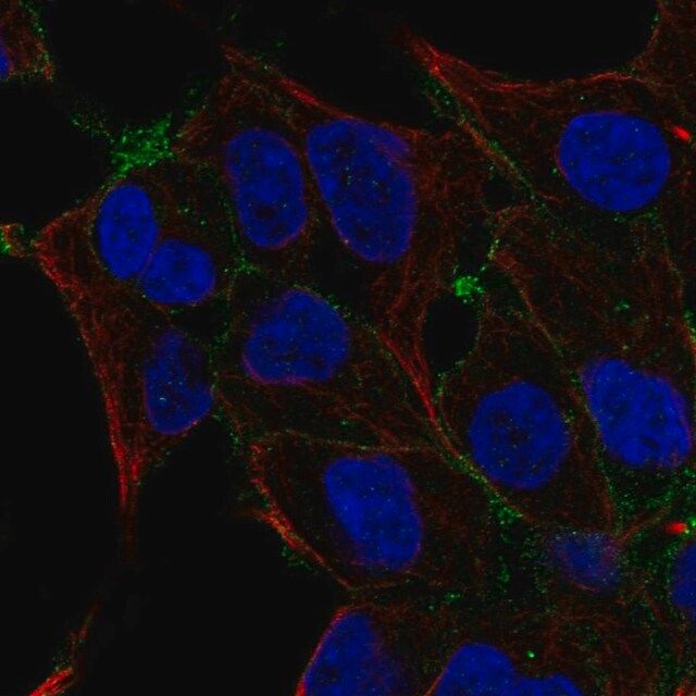 Anti-OSR2 antibody produced in rabbit