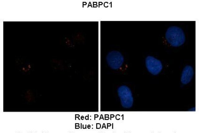 Anti-PABPC1