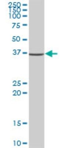 Anti-NSDHL antibody produced in mouse