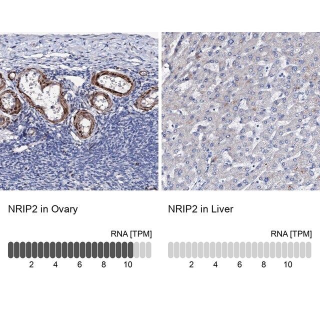 Anti-NRIP2 antibody produced in rabbit