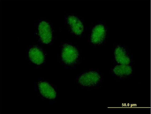 Anti-NSMCE1 antibody produced in mouse