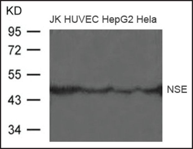 Anti-NSE antibody produced in rabbit