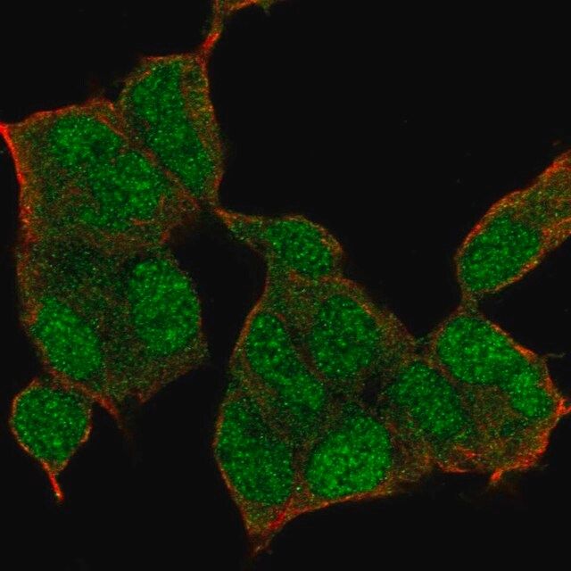 Anti-NSD1 antibody produced in rabbit