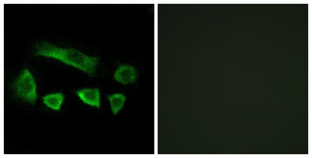 Anti-NT5C1B antibody produced in rabbit