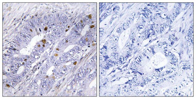 Anti-Nuclear Receptor NR4A1 antibody produced in rabbit