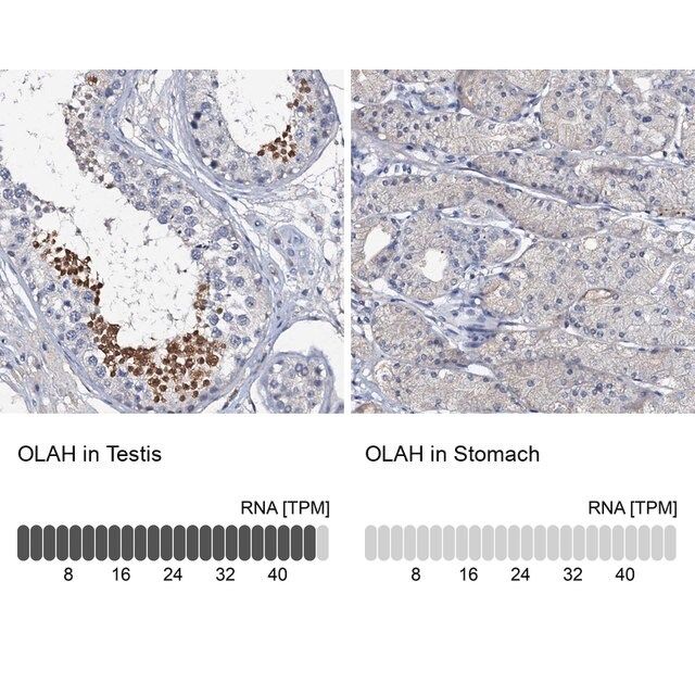 Anti-OLAH antibody produced in rabbit