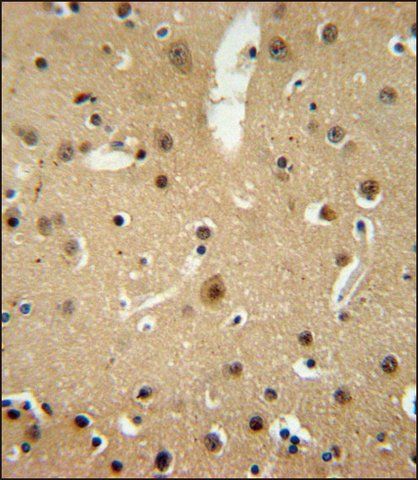 ANTI-NMB (CENTER) antibody produced in rabbit