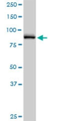 Anti-NPHP1 antibody produced in rabbit