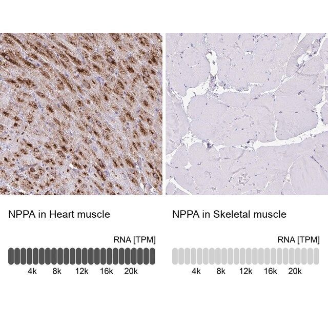 Anti-NPPA antibody produced in rabbit