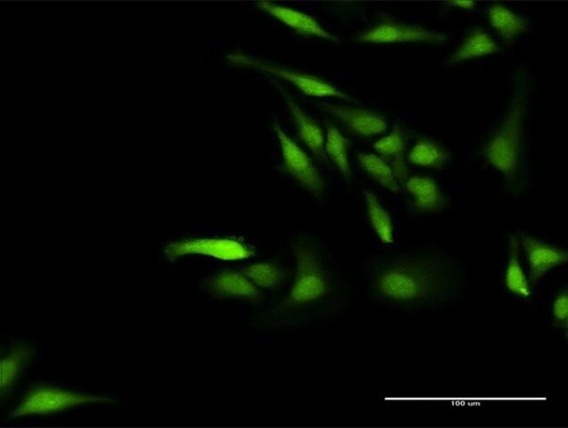 Anti-NPLOC4 antibody produced in rabbit