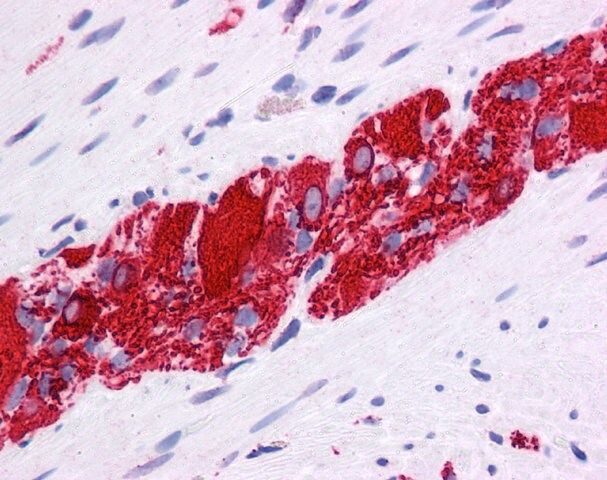 Anti-NR2E1 antibody produced in rabbit