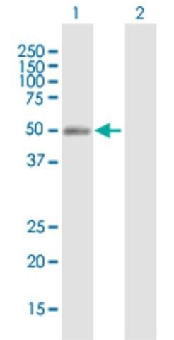 Anti-NR2F2 antibody produced in mouse