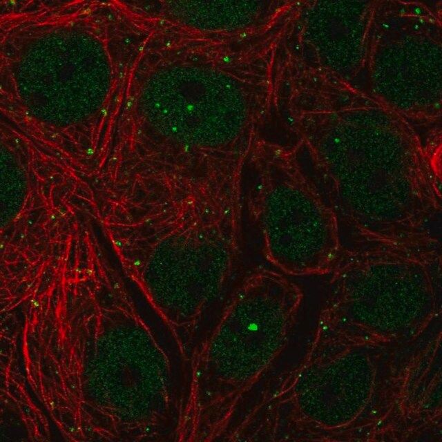 Anti-NELFCD antibody produced in rabbit