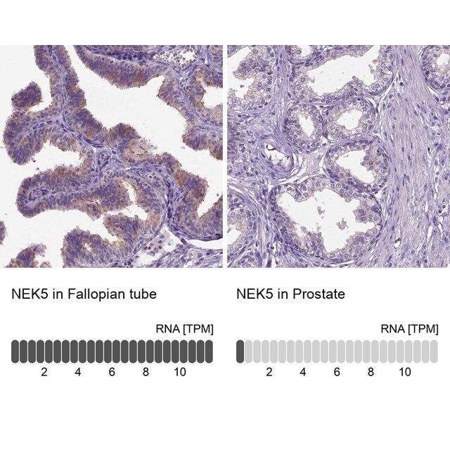 Anti-NEK5 antibody produced in rabbit